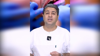 مشکل گگ یا عق زدن