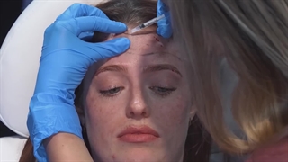 ویدئویی کوتاه از چگونگی تزریق بوتاکس