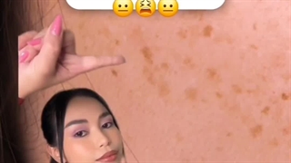 سرم آلفا آربوتین اوردینری | ضدلک قوی |