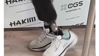 پروتز دوبل زیر زانو