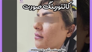 بهترین ژل برای کانتورینگ صورت لیفت ابرو