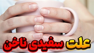 حقایقی جالب در مورد سفیدی ناخن ها