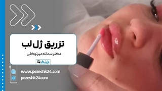دکتر سمانه میرتوکلی دکتر تزریق ژل لب در مشهد رفع افتادگی پلک