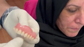 جاگزاری دندان بالا (دندان مصنوعی متحرک)