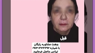 توصیه های دکتر علیزاده در کلینیک بین المللی اراد اصفهان برای شفاف و جوان شدن پوست صورت