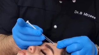 به تعویق انداختن بوتاکس