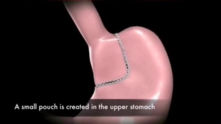 دکتر علی عابدینی.جراح برداشتن توده