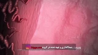دکتر فرانک پری افسای بهترین دکتر زنان بندرعباس لیپوماتیک