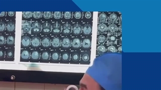 دکتر میثاق شفیع‌زاد؛ فوق تخصص جراحی مغز و اعصاب