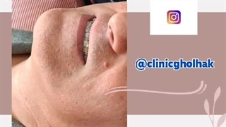 ارتودنسی دندان کلینیک قلهک