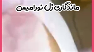 ماندگاری ژل نورامیس چقدر است؟