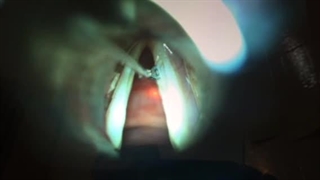 دکتر مسعود کاظمی بهترین جراح حنجره ایران