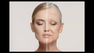 بلفاروپلاستی