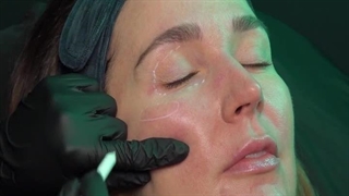 مزوژل زیر چشم جالپرو یانگ آی | Jalupro young eye