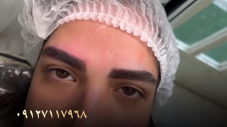 میکروبلیدینگ به سبک لیفت بروز