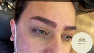 انجام همزمان بن مژه و فیبروز ابرو