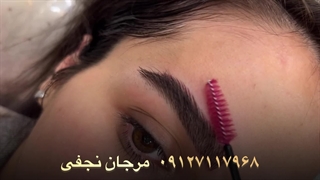 فیبروز ابرو به سبک لیفت