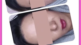روش های چاقی دائمی صورت کشیدن دندان