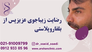 رضایت زیباجوی عزیز پس ازبلفارو پلاستی