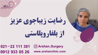 رضایت زیباجوی عزیز از بلفاروپلاستی