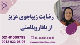 رضایت زیباجوی عزیز از بلفاروپلاستی