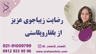 رضایت زیباجوی عزیز از بلفاروپلاستی