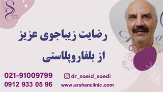 رضایت زیباجوی عزیز از بلفاروپلاستی