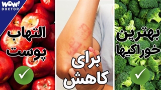 بهترین خوراکی ها برای کاهش التهاب پوست پیست ؟ کاشت ریش