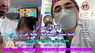 فیلم واقعی - بهترین سن ختنه ؟ بهترین تکنیک ختنه ؟ استاد دکتر بلندی