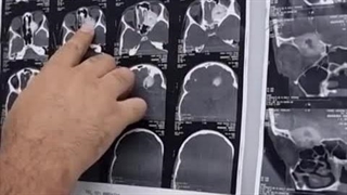 چه چیزی توی عمق چشماته