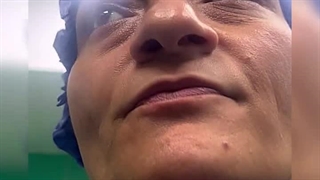 دکتر علیرضا آذری جراح بینی ساری