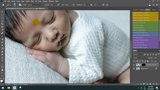 اکشن های روتوش نوزاد