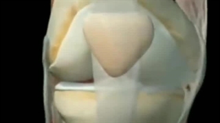 فیزیوتراپی نیکان ساری