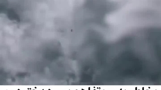 سمسار جاودان برداشتن زگیل