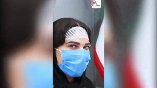 کاشت ابرو؛ بهترین تصمیم زندگیم! توصیه من به شما