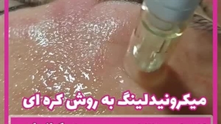 روش‌های جوانسازی پوست با دستگاه پلاستیک لثه