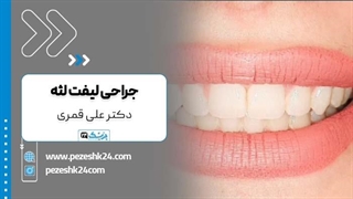 دکتر علی قمری دندانپزشک ایمپلنت و لثه در تهران پلاسماجت