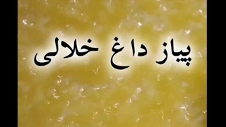 پیاز داغ خلالی