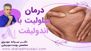 میدونی چقدر راحت سلولیت درمان میشه