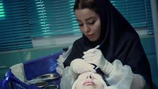 نمونه کاشت ابرو در کلینیک سلامت ایده آل