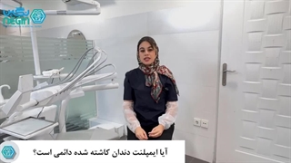 آیا کاشت ایمپلنت دندان دائمی است؟ دکتر نگین اثنی عشری