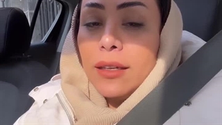 دکتر سحر فرزانه بررسی لک صورت