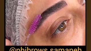 مرکز میکروبلیدینگ سمانه بیوتی بلیچینگ دندان