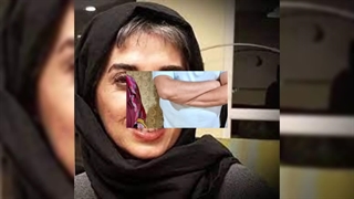 تغییر چهره «خاله پوری» سریال از سرنوشت