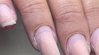 کاشت ناخن حمیده مقدم لیزر صورت
