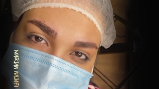 فیبروز ابرو به سبک طبیعی