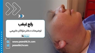 دکتر مژگان کریمی دکتر جراحی غبغب در تهران میکرونیدلینگ