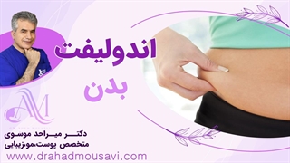 اندولیفت بدن