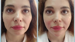 مرکز تخصصی جوانسازی دلرخ