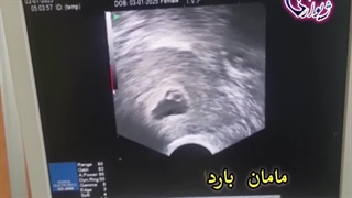 مرکز ناباروری ژیوار